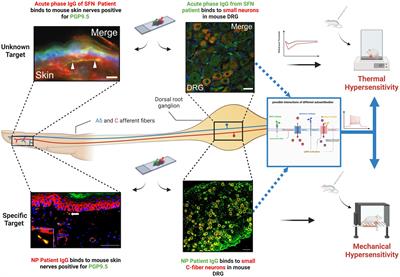 A role for pathogenic autoantibodies in small fiber neuropathy?